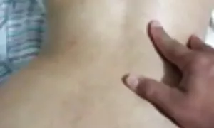 Dalam isteri prolaps ...